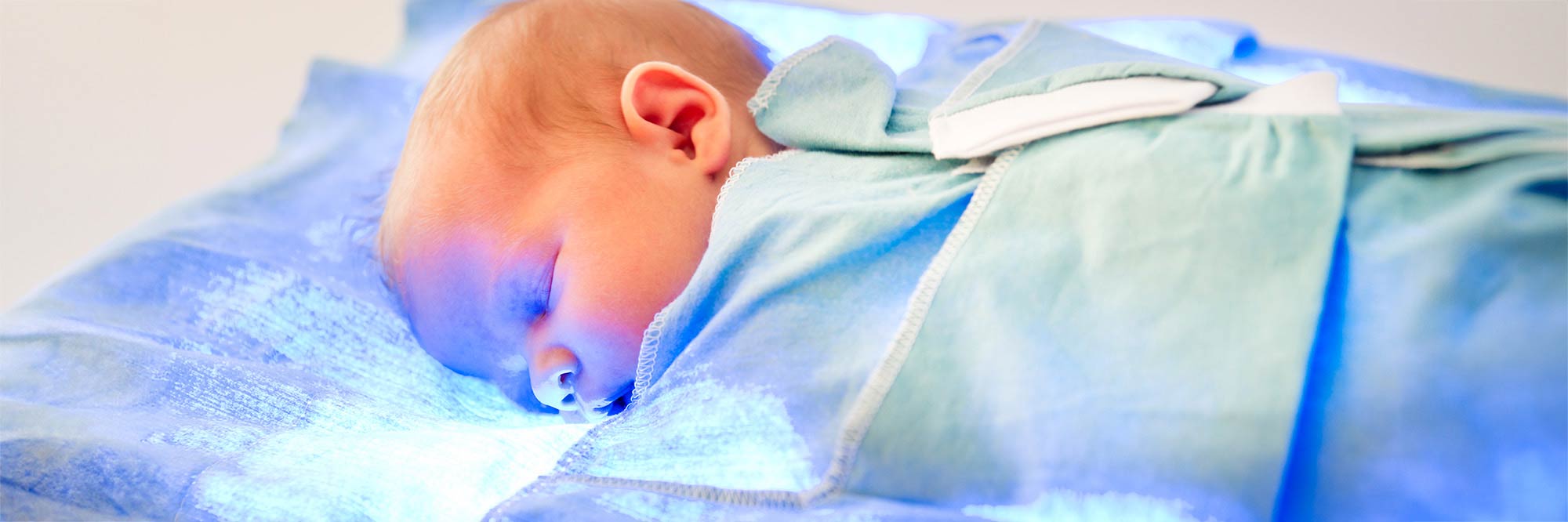 Understanding jaundice in newborns, what causes it and the different treatment options